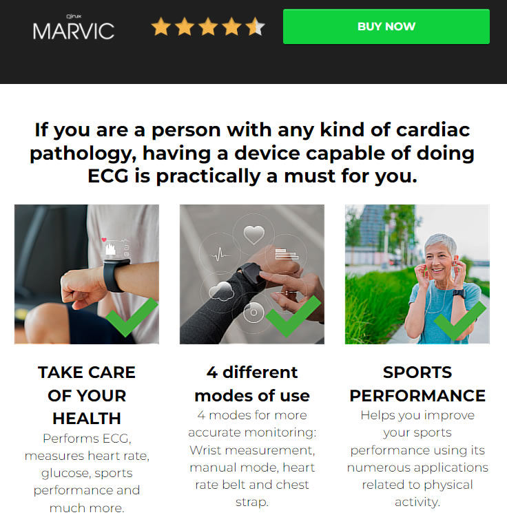 The Qinux Marvic ECG Smartwatch Review: Your Health Companion on Your Wrist